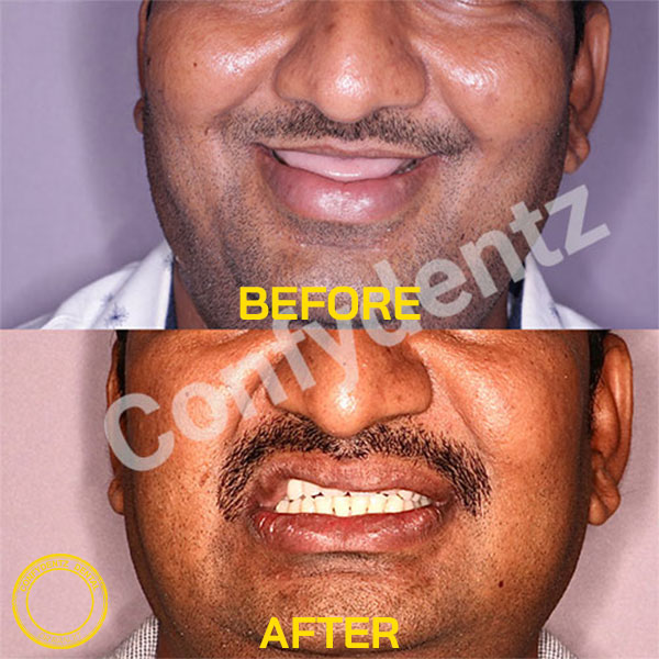 Confydentz dental case reports