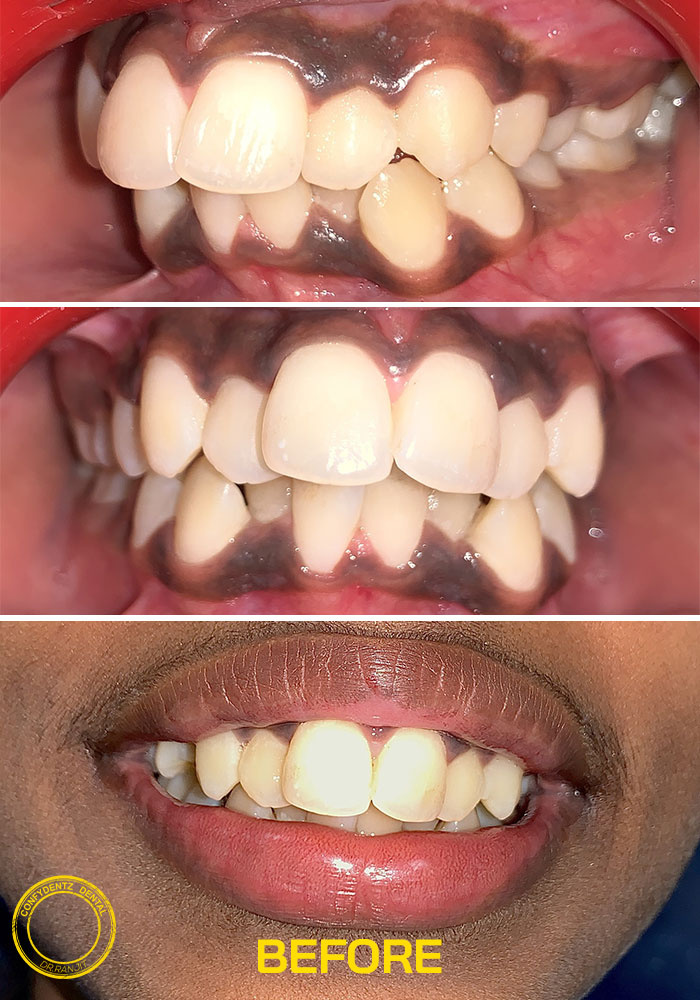 Confydentz dental case reports