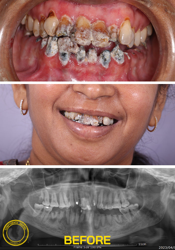 Confydentz dental case reports