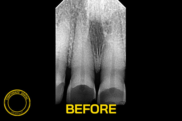 Confydentz dental case reports