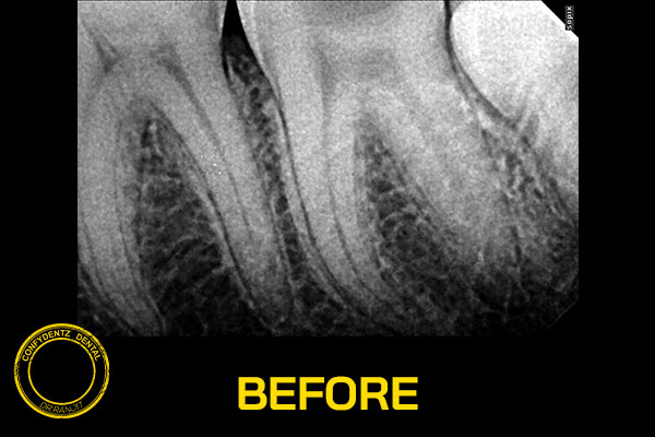 Confydentz dental case reports