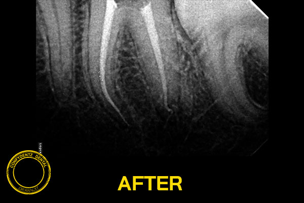 Confydentz dental case reports