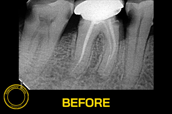 Confydentz dental case reports