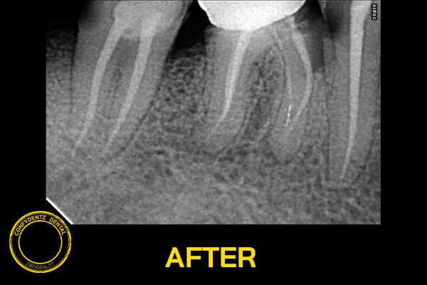 Confydentz dental case reports