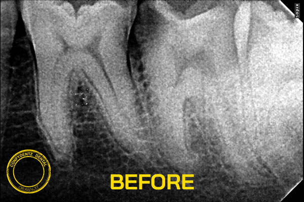 Confydentz dental case reports