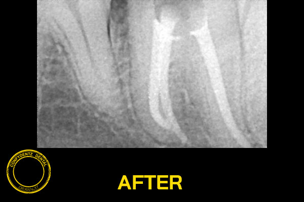 Confydentz dental case reports