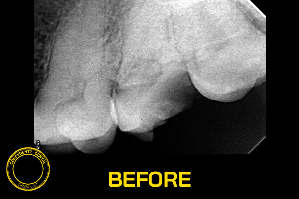 Confydentz dental case reports
