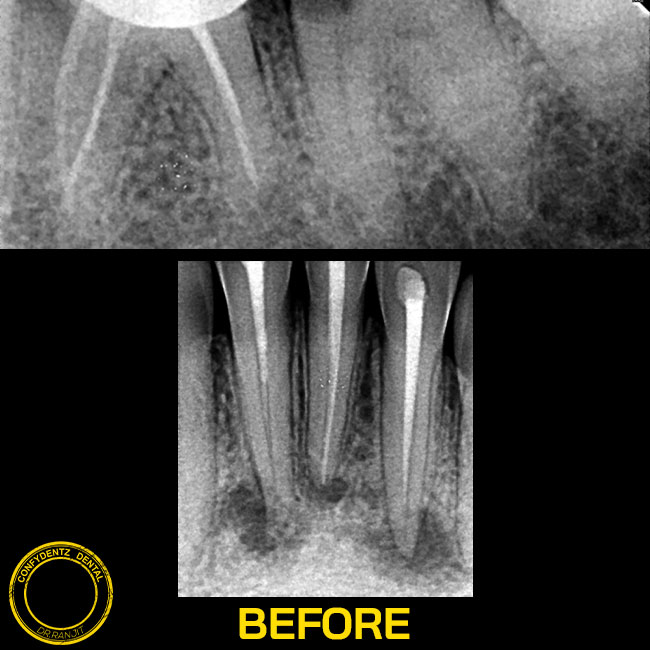 Confydentz dental case reports
