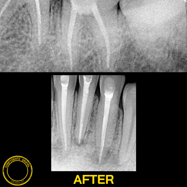 Confydentz dental case reports