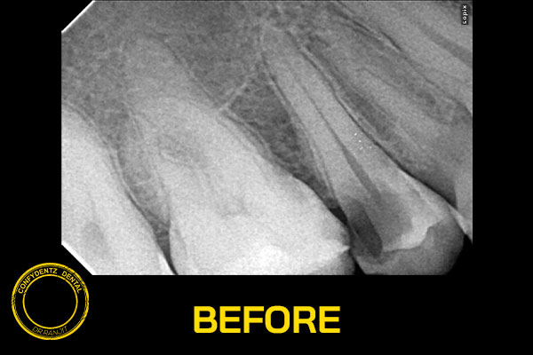 Confydentz dental case reports