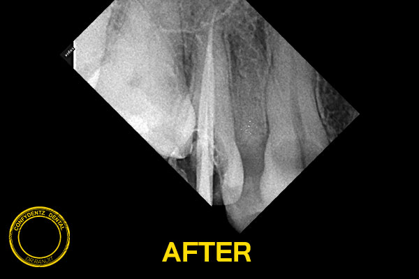 Confydentz dental case reports