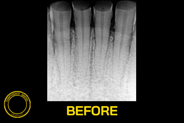 Confydentz dental case reports
