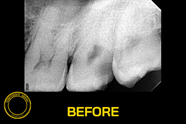 Confydentz dental case reports