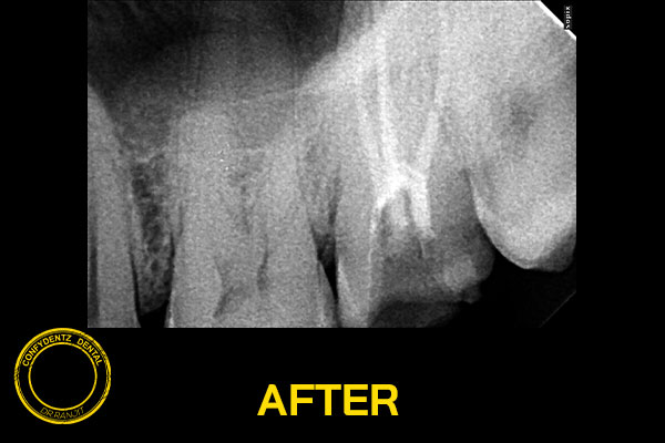 Confydentz dental case reports