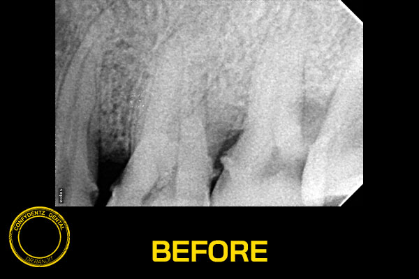 Confydentz dental case reports