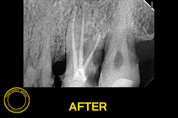 Confydentz dental case reports