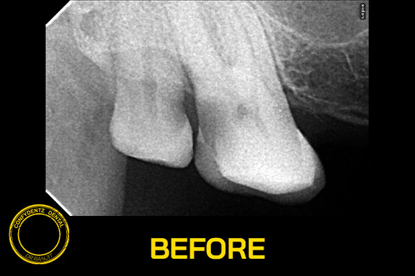 Confydentz dental case reports