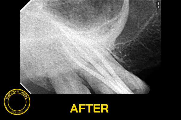 Confydentz dental case reports