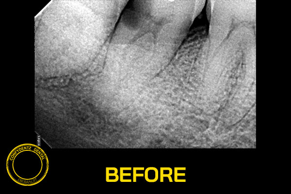 Confydentz dental case reports