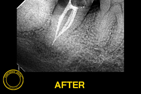 Confydentz dental case reports